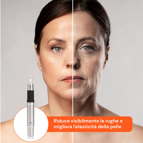 Dr. Fuchs Microneedling Rigenera Pelle Trattamento Rughe